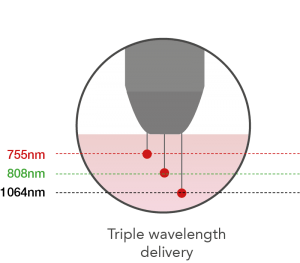Triple-wavelength-delivery