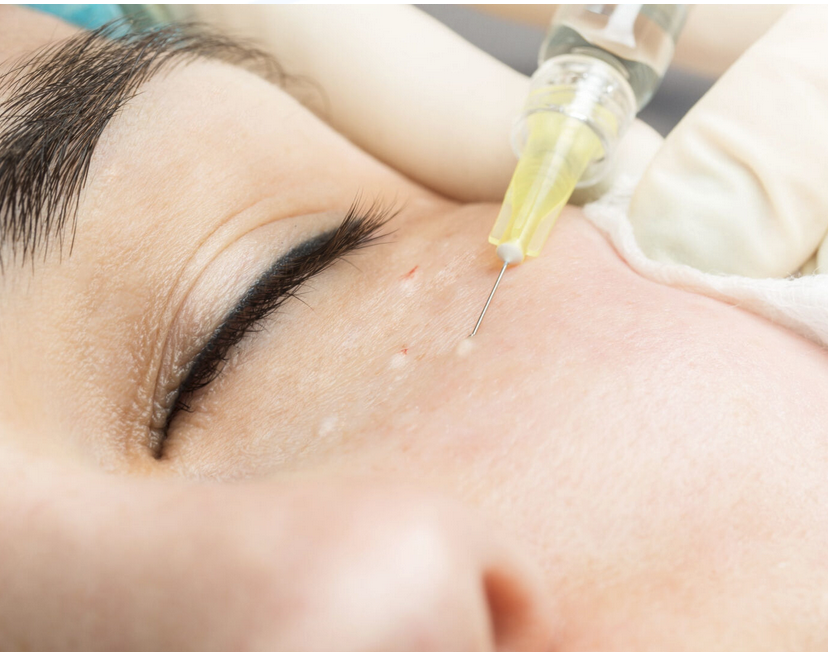 Under Eye Treatments Under Eye Treatments