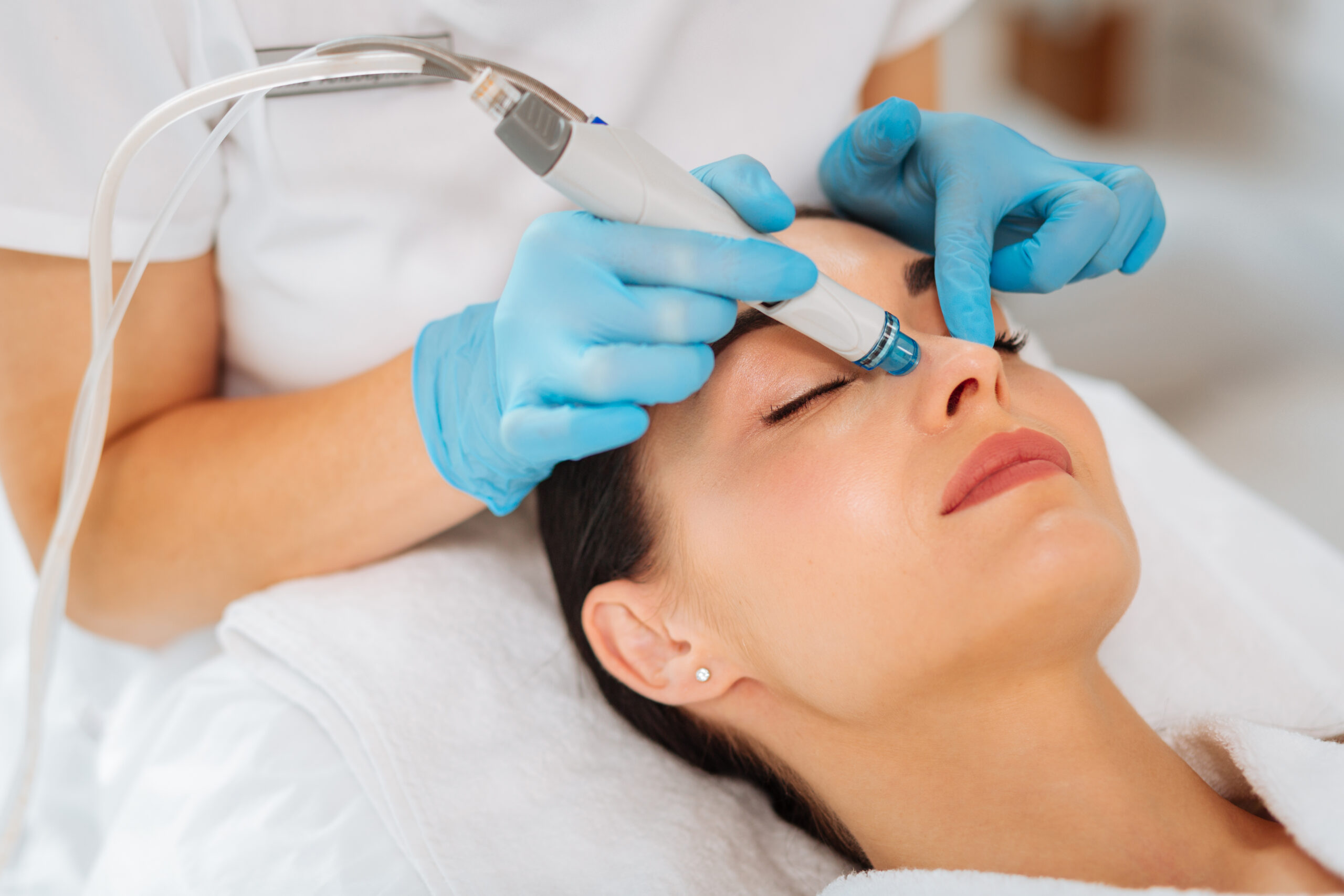 Skin Rejuvenation treatments Middlewich Cheshire Skin Rejuvenation treatments Middlewich Cheshire