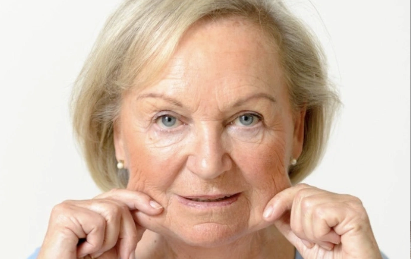 Jowl Treatments Middlewich Cheshire Jowl Treatments Middlewich Cheshire