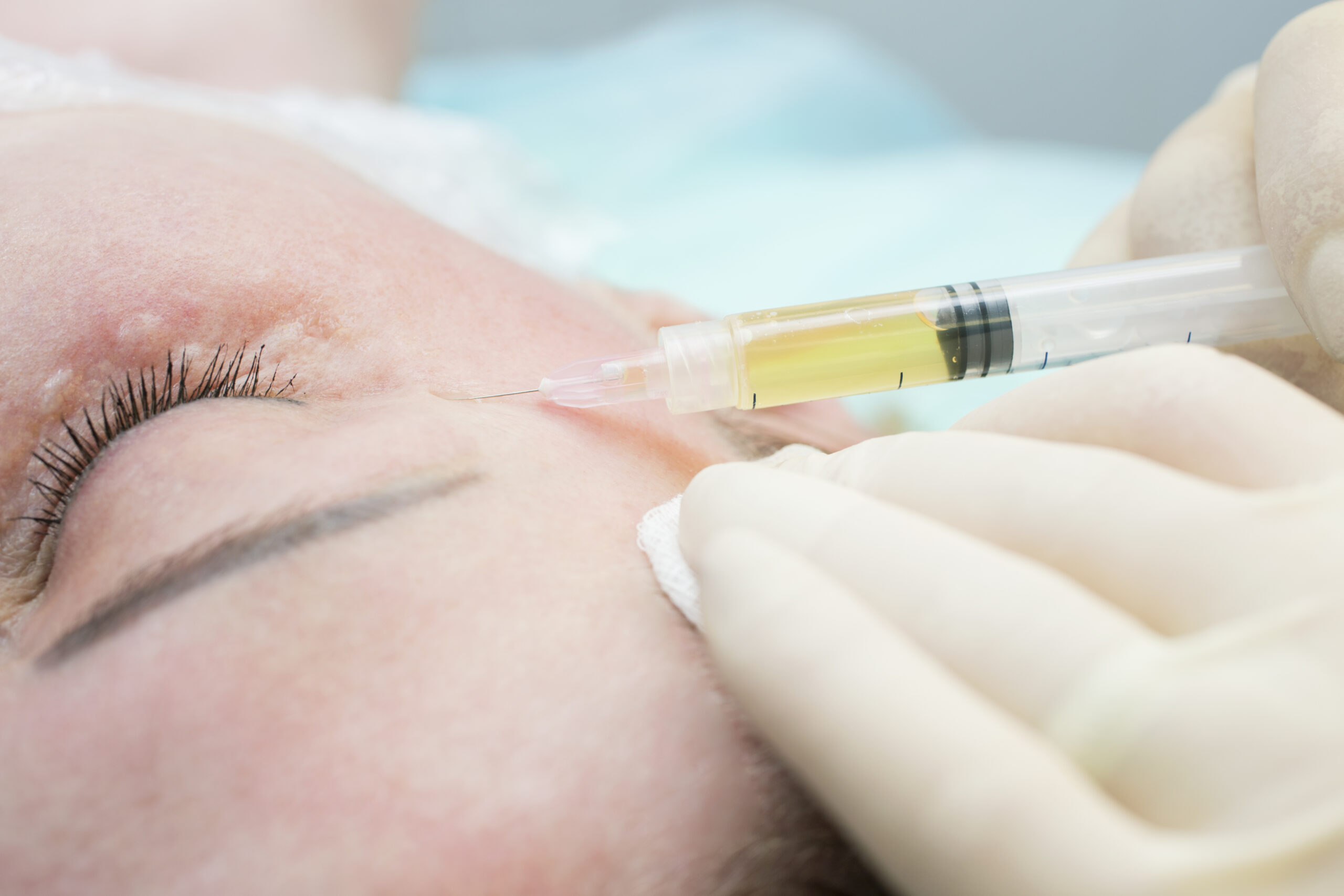 Anti ageing injection treatments Cheshire Clinic
